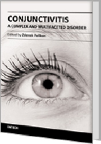 Conjunctivitis A Complex And Multifaceted Disorder Ist Zdenek Pelikan
