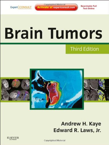 Brain Tumors An Encyclopedic Approach 3rd Edition 3rd Edition Andrew H Kaye