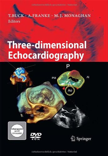 Threedimensional Echocardiography 1st Edition Thomas Buck Andreas Franke
