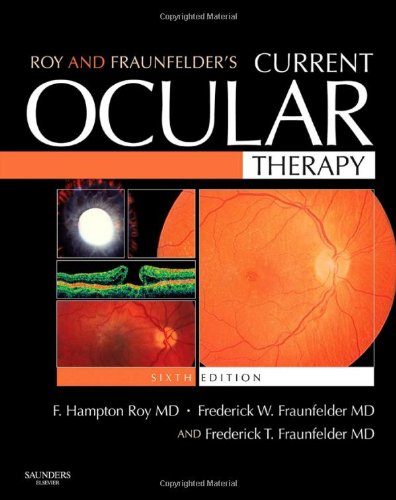 Roy And Fraunfelders Current Ocular Therapy 6th Edition 6th Edition F Hampton Roy Md Facs