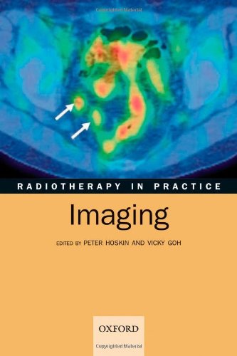 Radiotherapy In Practice Imaging 1st Edition Peter Hoskin Vicky Goh