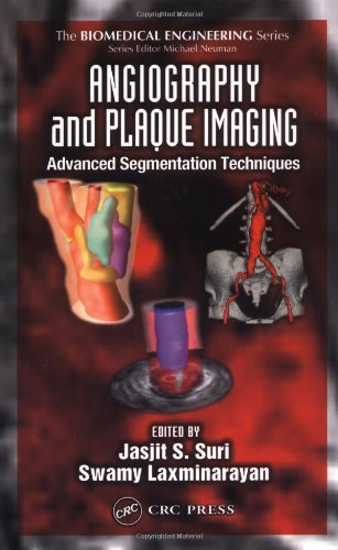Angiography And Plaque Imaging Advanced Segmentation Techniques 1st Edition Swamy Laxminarayan
