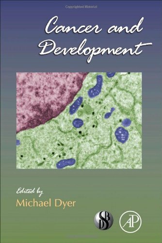 Cancer And Development 1st Edition Michael A Dyer Eds