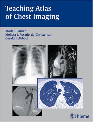 Teaching Atlas Of Chest Imaging 1st Edition Mark Parker Melissa De Christenson