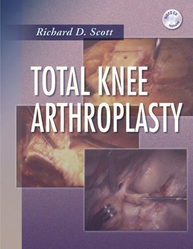 Total Knee Arthroplasty Richard D Scott