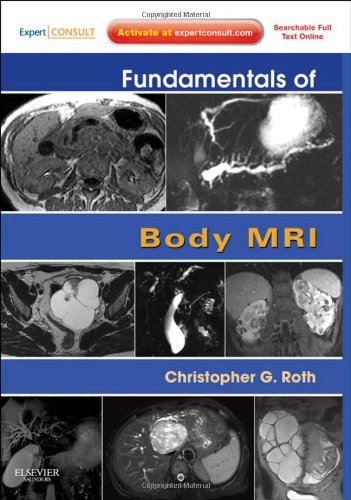 Fundamentals Of Body Mri 1 Pappsc Christopher G Roth Md