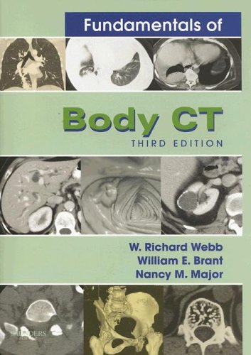 Fundamentals Of Body Ct 3rd Edition 3rd Edition W Richard Webb