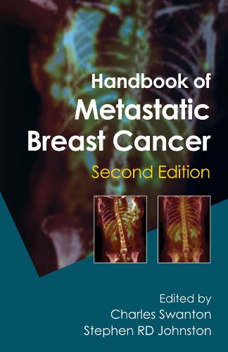 Handbook Of Metastatic Breast Cancer Second Edition 2nd Edition Charles Swanton Editor