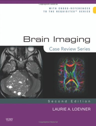 Brain Imaging Case Review Series Second Edition Second Edition Laurie A Loevner Md