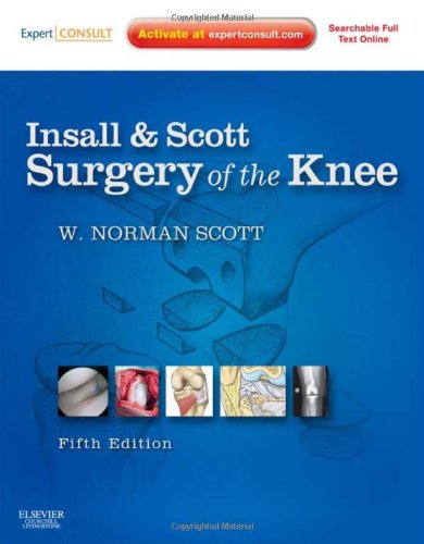 Insall Scott Surgery Of The Knee Expert Consult 5th Edition W Norman Scott