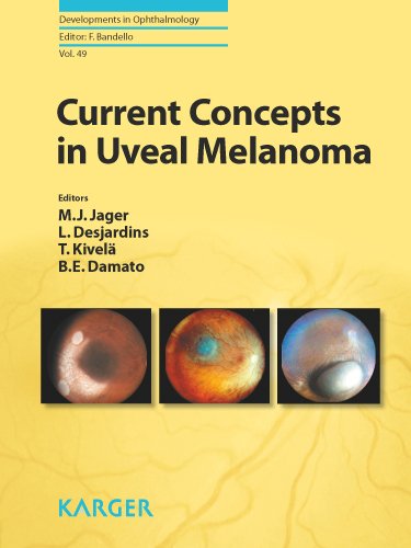 Current Concepts In Uveal Melanoma Developments In Ophthalmology 1st Edition M J Jager