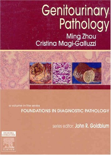 Genitourinary Pathology A Volume In Foundations In Diagnostic Pathology Series High Yield Pathology 1st Edition Ming Zhou Md Phd