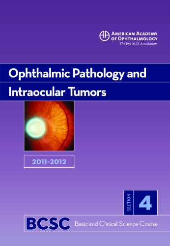 20112012 Basic And Clinical Science Course Section 4 Ophthalmic Pathology And Intraocular Tumors Basic Clinical Science Course Revised Edition Robert H Rosa Jr