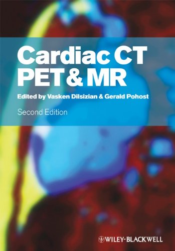 Cardiac Ct Pet And Mr Second Edition 2nd Edition Vasken Dilsizian