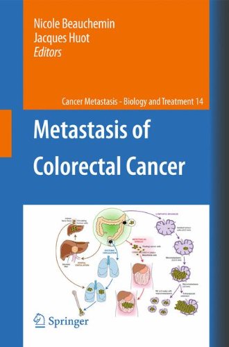 Metastasis Of Colorectal Cancer 1st Edition Nicolas Porquet Stphanie Gout