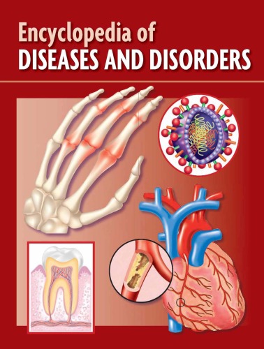 Encyclopedia Of Diseases And Disorders Matthew Peterson Md Gregg Y Lipschick