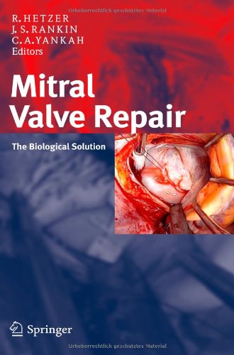 Mitral Valve Repair 1st Edition H Siniawski Md Phd M Hbler Md