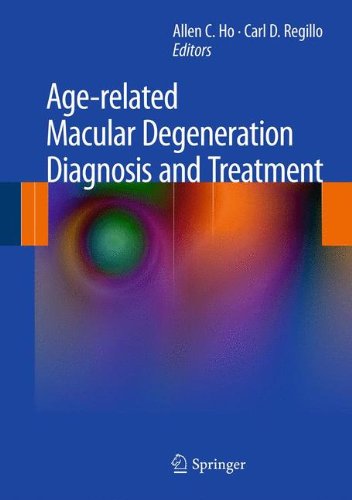 Agerelated Macular Degeneration Diagnosis And Treatment 1st Edition Daniel T Kasuga Bs Auth
