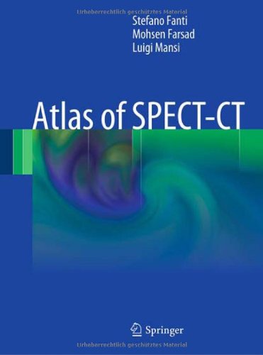 Atlas Of Spectct 1st Edition Stefano Fanti Mohsen Farsad Luigi Mansi Auth