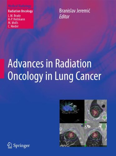 Advances In Radiation Oncology In Lung Cancer 2nd Edition Dusan Milanovic Auth