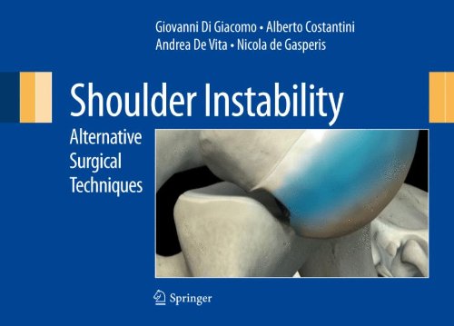 Shoulder Instability Alternative Surgical Techniques 1st Edition Eiji Itoi