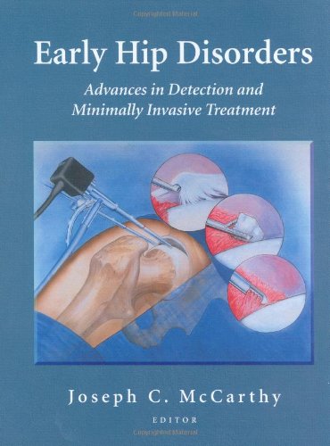 Early Hip Disorders Advances In Detection And Minimally Invasive Treatment 1st Edition Joseph C Mccarthy