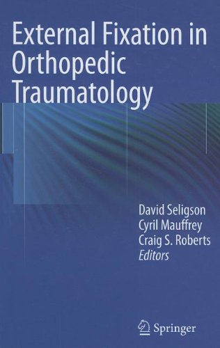 External Fixation In Orthopedic Traumatology 1st Edition Hanschristoph Pape