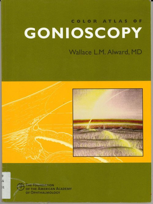 Color Atlas Of Gonioscopy 1st Wallace Lm Alward
