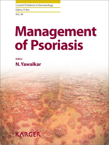 Management Of Psoriasis 1st Edition Nikhil Yawalkar