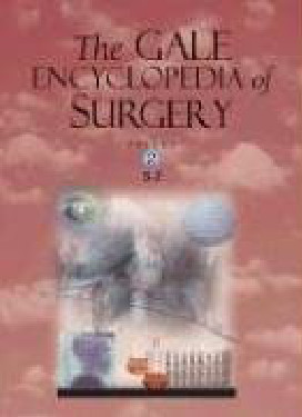 Gale Encyclopedia Of Sugery Anthony J Senagore Md