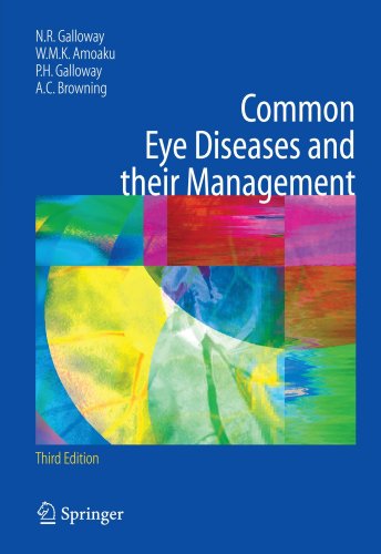 Common Eye Diseases And Their Management 3rd Ed 3rd Edition Nicholas R Galloway