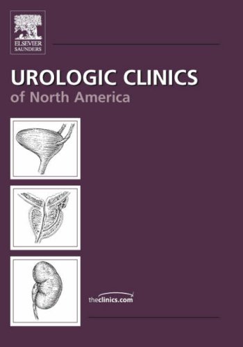 Testicular Cancer An Issue Of Urologic Clinics The Clinics Surgery 1st Edition Joel Sheinfeld