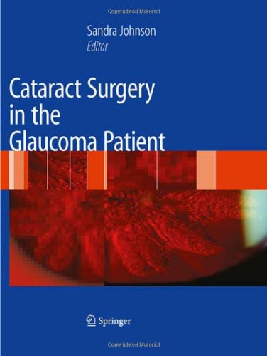 Cataract Surgery In The Glaucoma Patient 1st Edition Graham A Lee