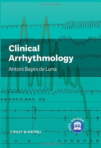Clinical Arrhythmology 1st Edition Antonio Bays De Luna Md Fesc Facc