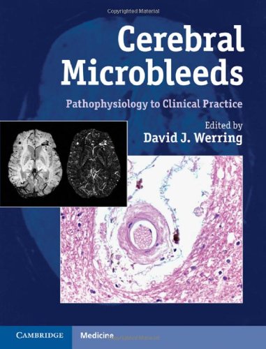 Cerebral Microbleeds Pathophysiology To Clinical Practice 1st Edition David J Werring