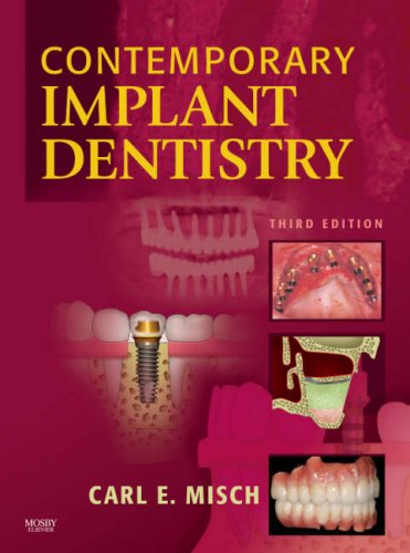 Contemporary Implant Dentistry 3rd Edition Carl E Misch Dds Mds Phdhc