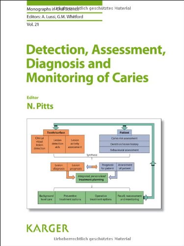 Detection Assessment Diagnosis And Monitoring Of Caries 1st Edition Nigel Pitts