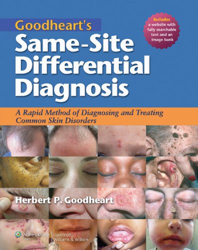 Goodhearts Samesite Differential Diagnosis A Rapid Method Of Diagnosing Treating Common Skin Disorders 1st Edition Herbert P Goodheart