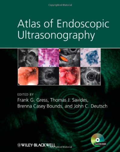 Atlas Of Endoscopic Ultrasonography 1st Edition Frank Gress Thomas Savides