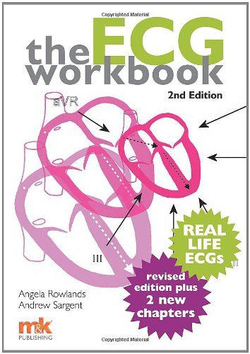 The Ecg Workbook 2nd Revised Edition Angela Rowlands Andrew Sargent