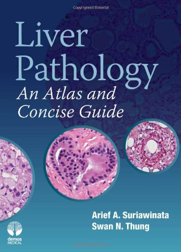 Liver Pathology An Atlas And Concise Guide 1st Edition Arief Suriawinata Md