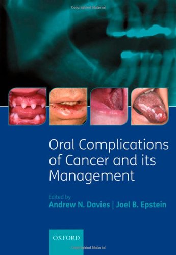 Oral Complications Of Cancer And Its Management 1st Edition Andrew N Davies