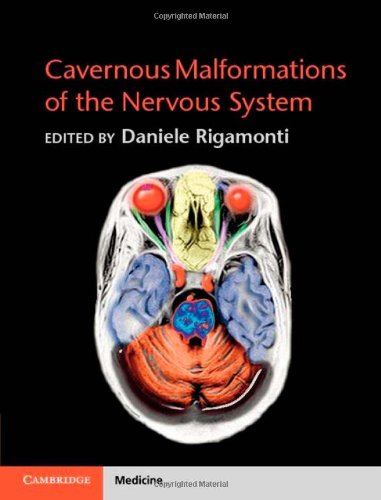 Cavernous Malformations Of The Nervous System 1st Edition Daniele Rigamonti Md