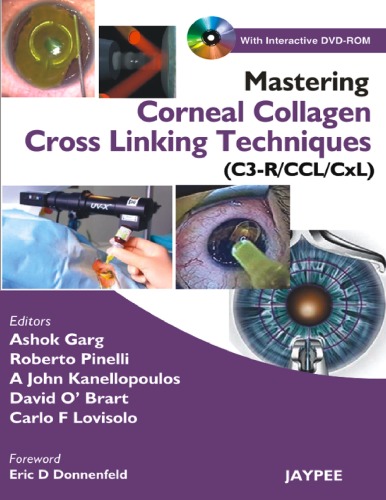 Mastering Corneal Collagen Cross Linking Techniques 1st Ashok Garg