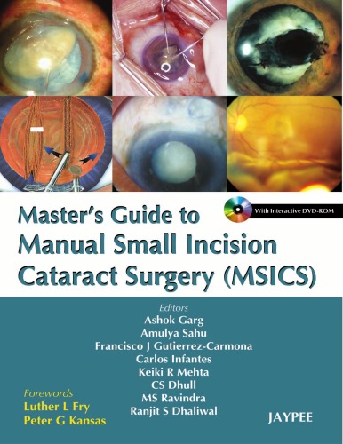 Masters Guide To Manual Small Incision Cataract Surgery 1st Edition Garg Ashok