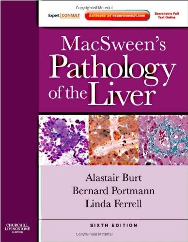 Macsweens Pathology Of The Liver Expert Consult Online And Print 6th Edition Alastair D Burt
