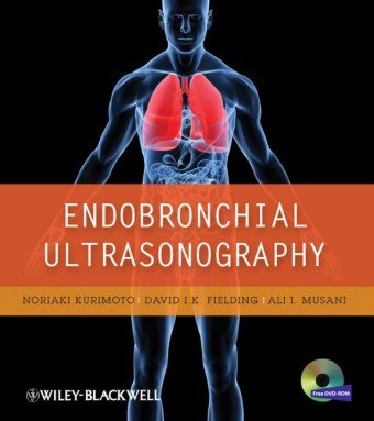 Endobronchial Ultrasonography 1st Edition Noriaki Kurimoto David Fielding