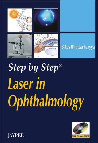 Step By Step Laser In Ophthalmology 1st Edition Bhattacharya