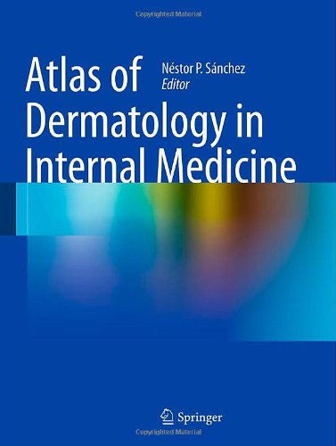 Atlas Of Dermatology In Internal Medicine 1st Edition Lesliane E Castrosantana Auth