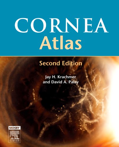 Cornea Atlas 2nd Edition 2nd Edition Jay Krachmer David Palay